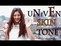 How to get rid of uneven skin tone