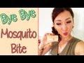 Bye Bye Mosquito bites!!