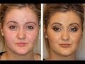 How To: Cover Up Acne Scarring With Make-Up