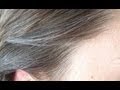 Premature Graying of Hair - Home Remedy