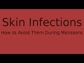 Skin Care - Dealing With Skin Infections During Monsoons